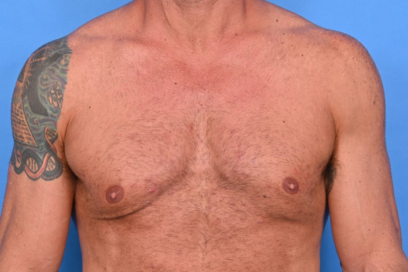 Patient Before & After Image