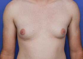 Patient Before & After Image