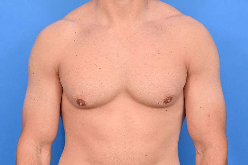 Patient Before & After Image