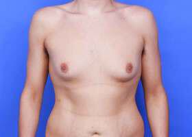 Patient Before & After Image