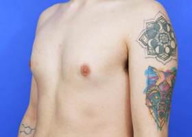 Patient Before & After Image