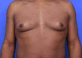 Patient Before & After Image