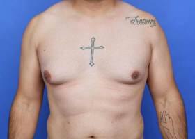 Patient Before & After Image