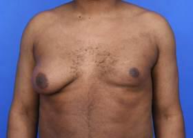 Patient Before & After Image