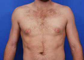 Patient Before & After Image