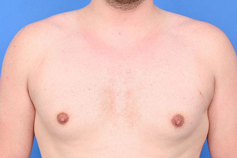 Patient Before & After Image