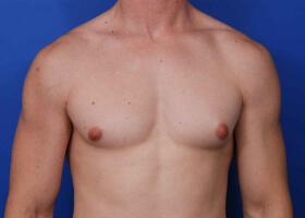 Patient Before & After Image