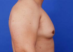 Patient Before & After Image