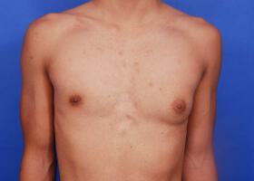 Patient Before & After Image