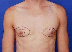 Patient Before & After Image