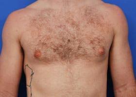 Patient Before & After Image