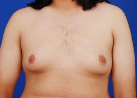 Patient Before & After Image