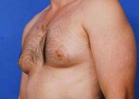 Patient Before & After Image