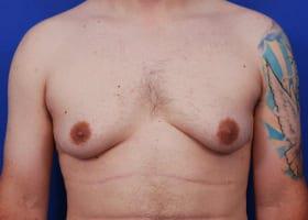 Patient Before & After Image