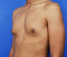 Patient Before & After Image