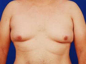 Patient Before & After Image