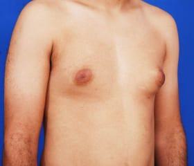 Patient Before & After Image