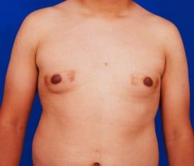 Patient Before & After Image