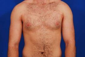 Patient Before & After Image