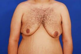 Patient Before & After Image