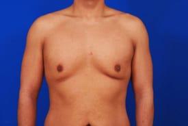 Patient Before & After Image