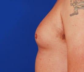 Patient Before & After Image