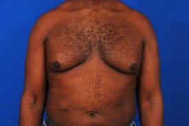 Patient Before & After Image