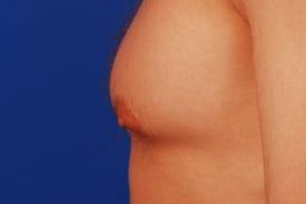 Patient Before & After Image