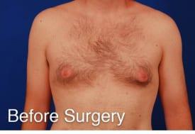 Patient Before & After Image