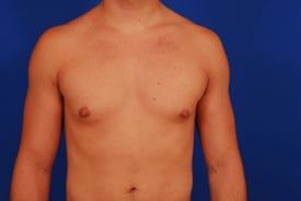 Patient Before & After Image