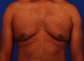 Patient Before & After Image