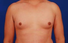 Patient Before & After Image