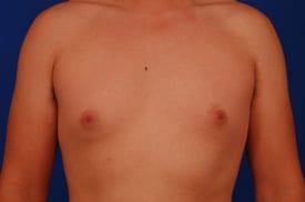 Patient Before & After Image