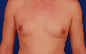 Patient Before & After Image