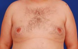 Patient Before & After Image