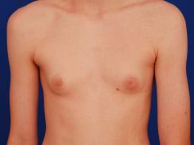 Patient Before & After Image