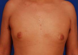 Patient Before & After Image