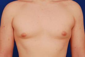 Patient Before & After Image