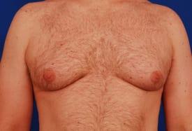 Patient Before & After Image