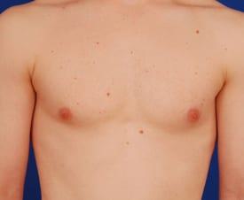 Patient Before & After Image