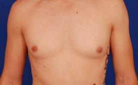 Patient Before & After Image