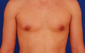 Patient Before & After Image