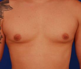 Patient Before & After Image