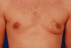 Patient Before & After Image