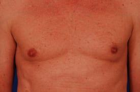 Patient Before & After Image