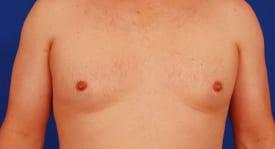 Patient Before & After Image