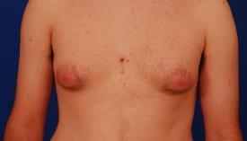 Patient Before & After Image