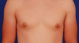 Patient Before & After Image