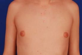 Patient Before & After Image