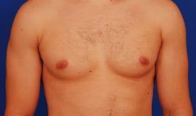 Patient Before & After Image